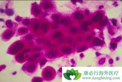 ����ɼ������˳�����ƹ�������ʲô�ô���