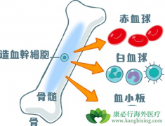 �˽��Ѫ����ԭ��ɰ������Ԥ����Ѫ��