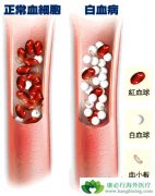 ������ϸ����Ѫ�����Ʒ�����ô���٣�