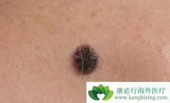 ��ɫ�������ڳ��ֳ�����֢״�������Ч���⣿