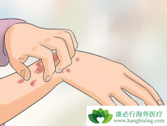 �������ɸ����ÿ��ܻ�Σ�����ߵ�Ƥ����֯����