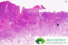 ����ϸ����֢״����Щ���ٴ�������Щ���Ʒ�����