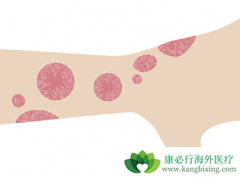 �߿�����м����ҩSKYRIZI���ձ�����