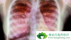 ʲô�Ƿβ���ά�����β���ά����������ƣ�