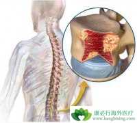 �ٴ��϶෢�Թ�������֢״����ͨ������Щ��