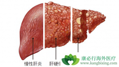 ʲô���������жϸ�Ӳ������Ӳ����ô���ƣ�