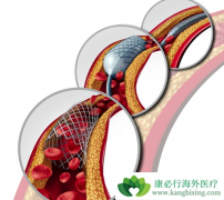 ����֧����������������ж�ã�����֧�������������ܶ���