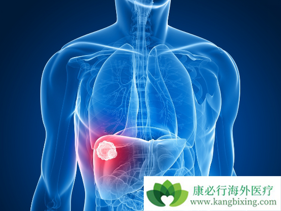 肺癌肝转移 肺癌肝转移
