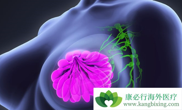 乳腺癌 乳腺癌