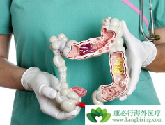 ����KRASҰ������ͻ��Ľ�ֱ����������ν��а������ƣ�