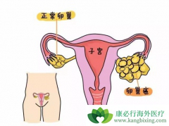 ��ͨŮ����η����ѳ���������֢״��