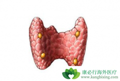 ��״��������ô���ƣ��ͼ�״�ٰ���ʲô��ͬ��