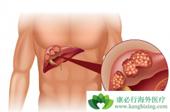 �ΰ�����֢״����һ�㶼����Щ��