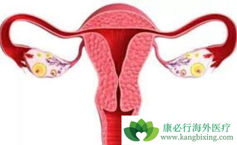 妇科肿瘤 妇科肿瘤