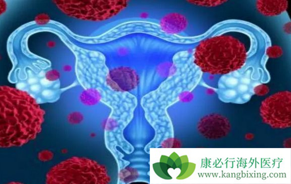 妇科肿瘤 妇科肿瘤