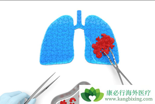 肺癌晚期能活多久 肺癌晚期能活多久