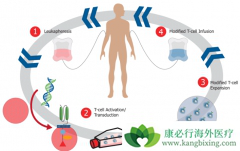 CAR-T�Ʒ����µ�ϸ�����ӷ籩����ô������