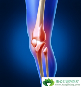 ������ϥ�ؽ��׵����Ʒ�������Щ��