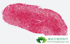 ��ɼ���뱴��������������Ѫ��������Ч����ǿ��