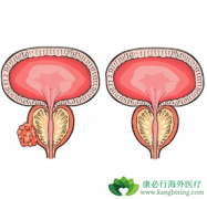 ת����ǰ���ٰ�������Ҫ�����Щ����ͻ�䣿