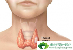 ��״�ٰ���֢�����ܻ����벡�������й�