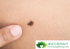 �ٴ��г����ĺ�ɫ��������֢״��ʲô��