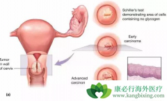 ��������������ɱ������Щ���ֱ�������ЧԤ����