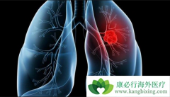 �����鵥���Է��۰�����Ч���Ƕ��٣�