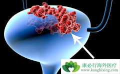 ���װ�֢״����Щ�����˰��װ����κ���