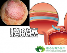 ת���԰��װ���atezolizumab����Ч����ô����