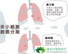 �����������Ʒ�Сϸ���ΰ����ߵ���Ч��ô����