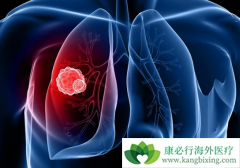 ������Сϸ���ΰ����Ʒ�����ôѡ��