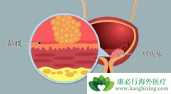 ���ڰ��װ�֢״ͨ��������Щ��