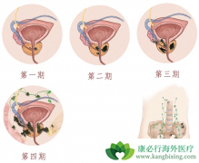 ǰ���ٰ�������ʲô���ã�ǰ���ٰ���������Щ��