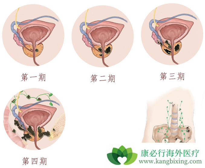 ǰ���ٰ�����