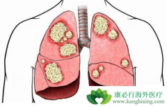 ���ȺͿ�Ѫ�Ƿΰ�����֢״��