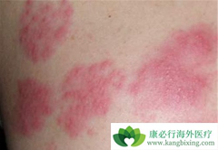 ʹ�÷��Ӱ���ҩ��������Ƥ����ô���ƣ�