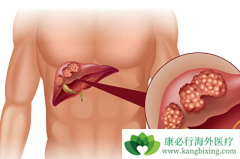 �ΰ�������ʲô֢״���ΰ���������֢״����Щ���ΰ�������֢״��ȫ