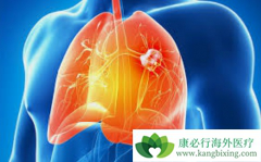 �ΰ����κ���Ӱ��ΰ�����Ч������������Щ��