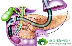 �������ٰ���֢״����Щ��