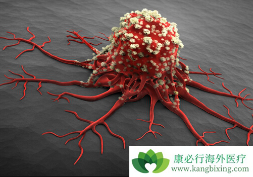 良性肿瘤与恶性肿瘤的区别 良性肿瘤与恶性肿瘤的区别