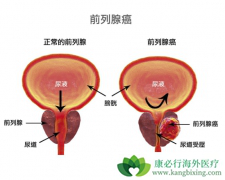 ǰ���ٰ���������Щ��ǰ���ٰ����ڶ���ǰ���ٰ�����������