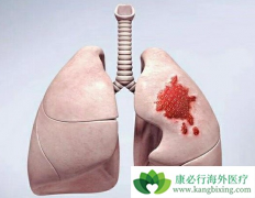 ��ķ�����ڷΰ������������򷢻�����Ҫ����