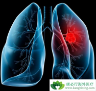 �������Ͷ���EGFR-TKI����������ȸ����÷�����ʲô��ͬ��