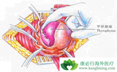 ��״����֢״�ͼ�״�������Ʒ�������