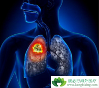 �ΰ����ڿ����κ����ճ��չ˷ΰ���Ⱦ��