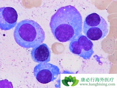 �෢�Թ�����֢״��Ҫ��������Щ���棿