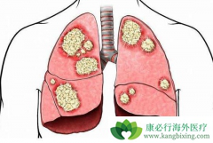 �ΰ��������κ��𣿳����������ǻ�����Щ�µ�ѡ��