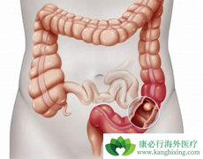 ���������ڽ�ֱ������������Щ���ã�