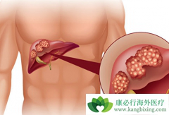 �Ҹβ�����Ⱦ�ǵ���ԭ���Ըΰ���һ��ԭ��֮һ��